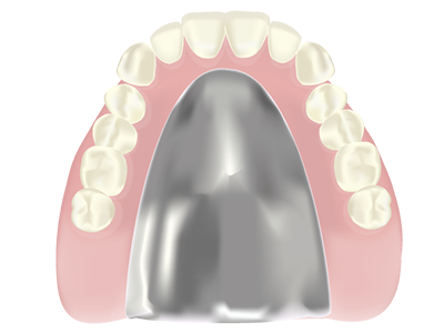 金属を使った薄い入れ歯
